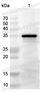 Anti-Monkeypox virus/MPXV D13L Polyclonal Antibody